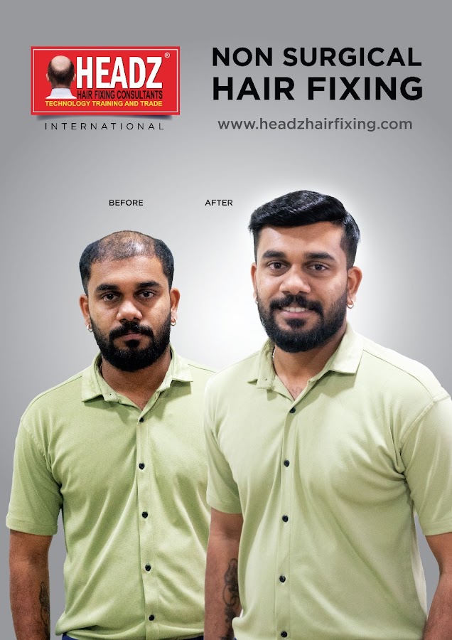 Headz Hair Fixing Centre | Hair Replacement — photo 3