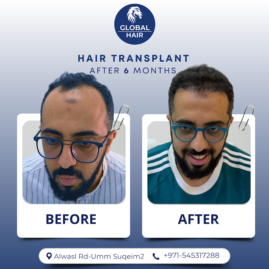 Global Hair Centre Dubai — photo 3