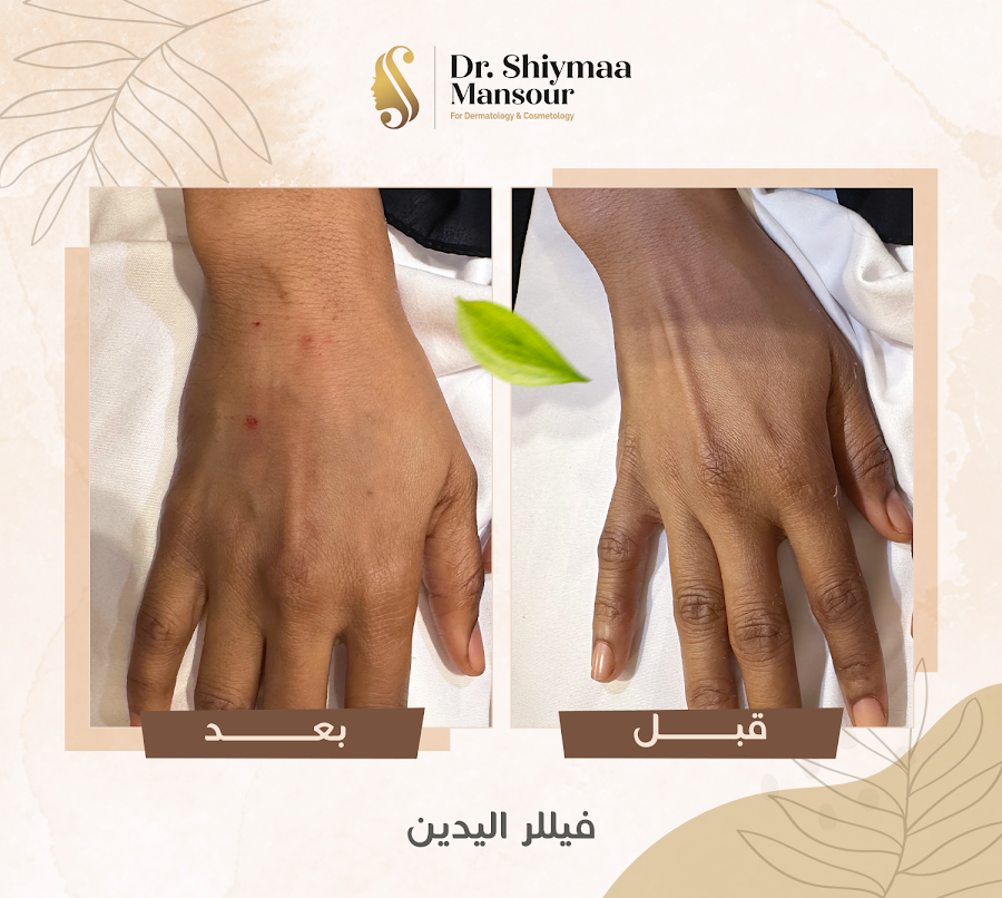 الدكتورة شيماء منصور | جلدية وتجميل وليزر بجدة — photo 4