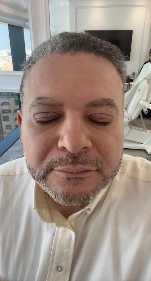 عيادات الدكتور محمد حافظ لجراحات التجميل