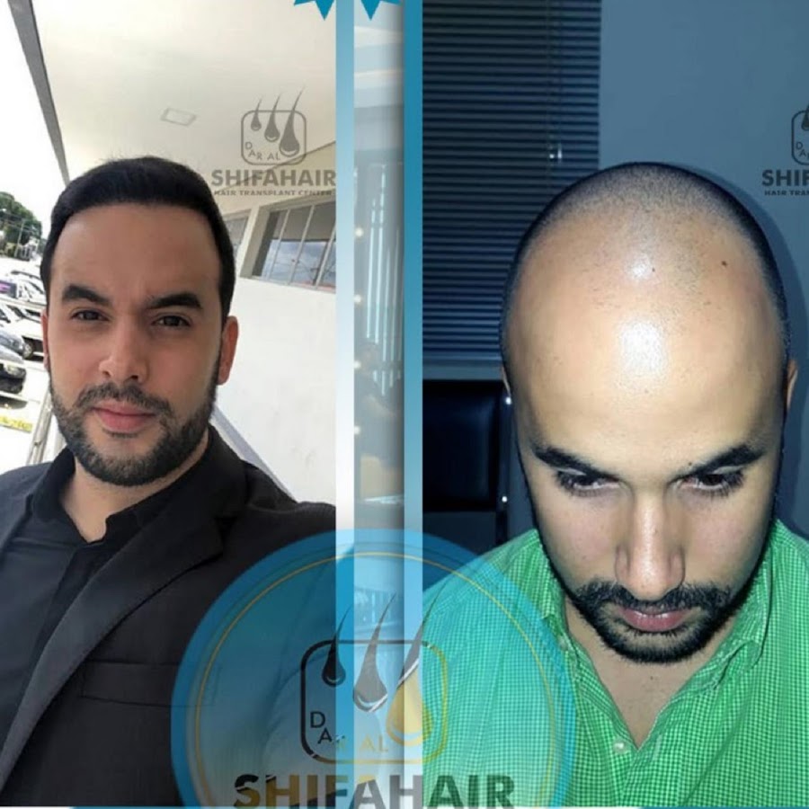daralshifahair — photo 5