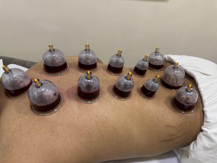 مركز نحو النجاح للحجامة - المنصورة، الدائري الجنوبي مخرج ١٩، أمام مركزالهرم التج — photo 1